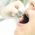 練馬でお勧めの歯科医院を紹介しちゃうよ